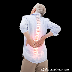 image Oxford back pain with lumbar spinal stenosis
